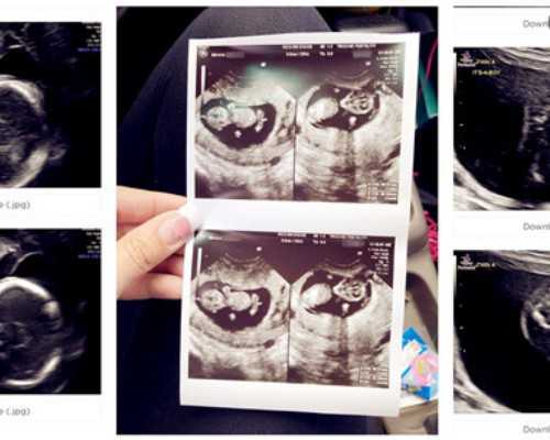 国内人工代孕公司,第三代试管婴儿总共费用多少？学会辨别很重要